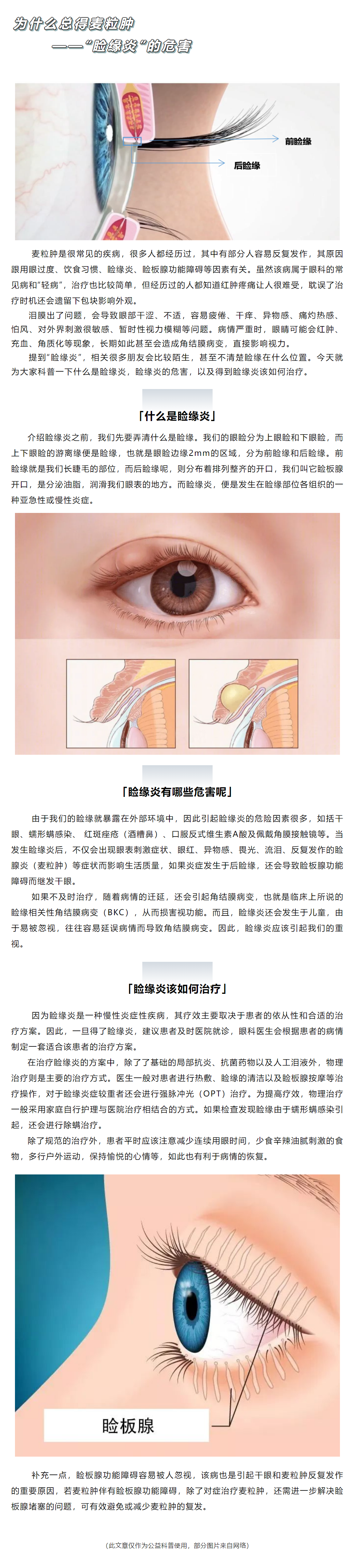 图1-8 双侧溃疡性睑缘炎-眼前节疾病-医学